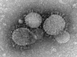        "    " ("Middle East Respiratory Syndrome Coronavirus",  MERS)