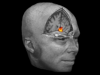     ,    ,    .   de Quervain et al., 2004